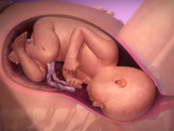 animation of full-term baby with head near vagina