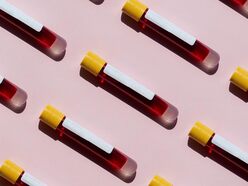 blood collection tubes laid out in a pattern